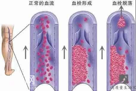 警惕！身上这部位的青筋“凸起”，也许是身体在报警！-1.jpg