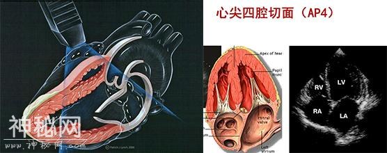 超声心动图的“五字真言”-1.jpg