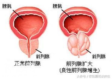 前列腺食疗保健方法-3.jpg