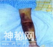 登革热病毒被带入澳洲！一男子被隔离！澳人担忧病毒席卷全澳-9.jpg