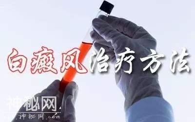 白癜风并非绝症，医生教你3种方法，快转给有需要的人！-3.jpg