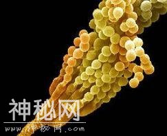 极强悍细菌——勇者菌 竟能活在核燃料环境-3.jpg