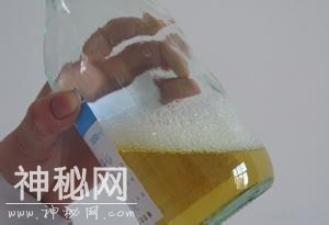 当身体出现缺水时，会有5个征兆，第一个常被忽略-2.jpg