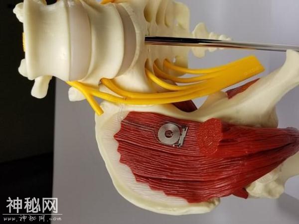 科学家发明小型神经修复装置 可在人体内降解-1.jpg