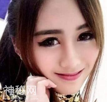 22岁女子清纯漂亮受人追捧，整容后变成了“外星人”-2.jpg