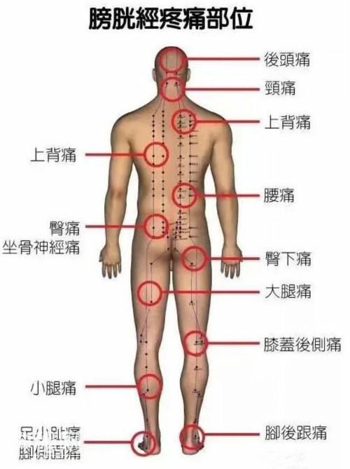 6张人体脏腑疼痛区高清图，一看就懂，记住了你就是家庭医生！-3.jpg