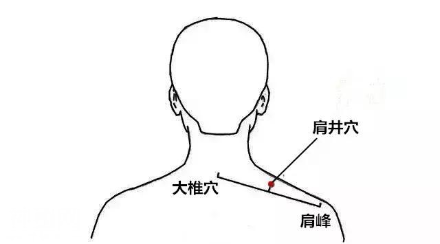 颈椎病的“标配”——肩井穴-1.jpg