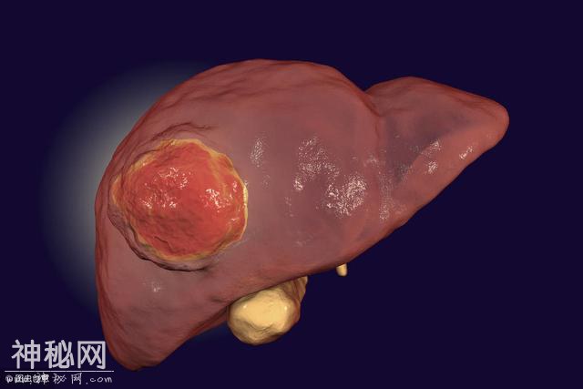 肝癌过来“打招呼”，身体会有这4个反应，别觉得是小事-1.jpg
