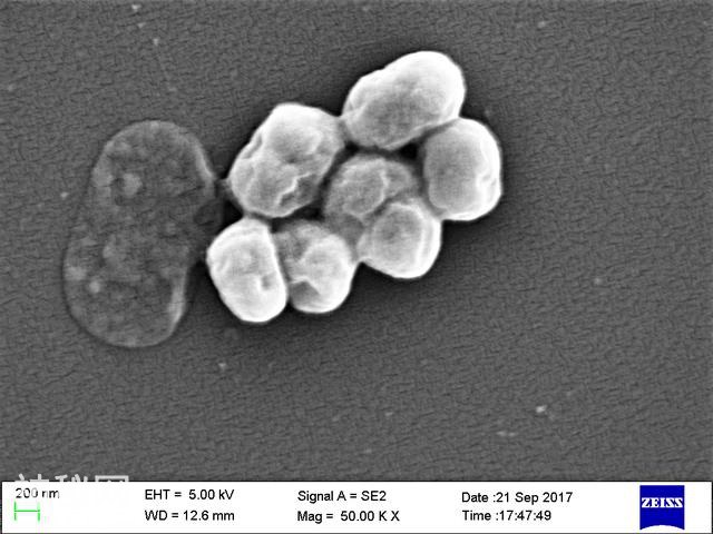 姜还是老的辣：看噬菌体如何对抗超级细菌-2.jpg