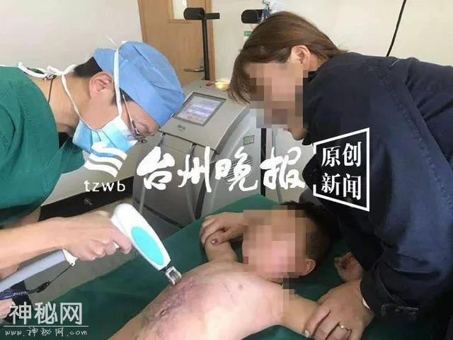 可怜！3岁娃得怪病身上长满“兽皮”，千里寻医到台州-4.jpg