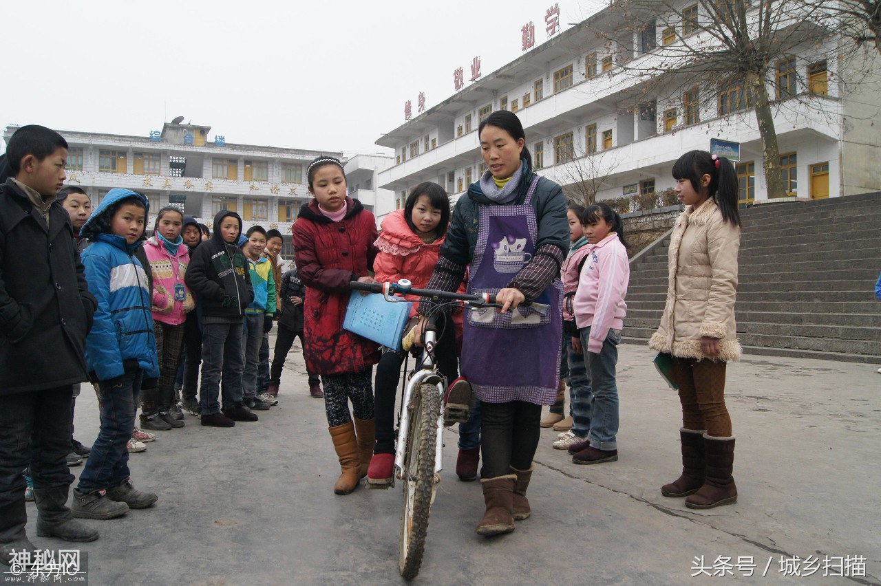 皮肤变黑变硬脱落，16岁女孩患“怪病”8年，可惜一直没查出病因-7.jpg