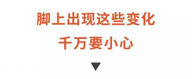 脚痛暗示糖尿病上身？这些脚部症状都在提醒你：身体出问题了-1.jpg