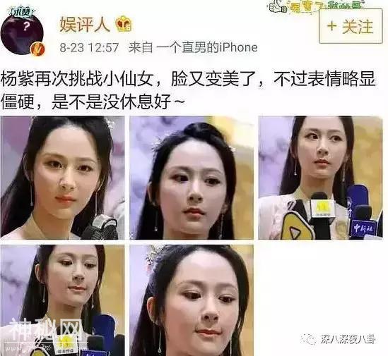 同样是贴满“整容玻璃心”标签的90后小花，为什么她就很少挨骂？-68.jpg