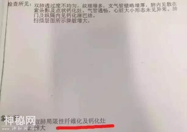 咳嗽、吐白痰、胸闷、憋气身体虚，小心是肺结节-3.jpg