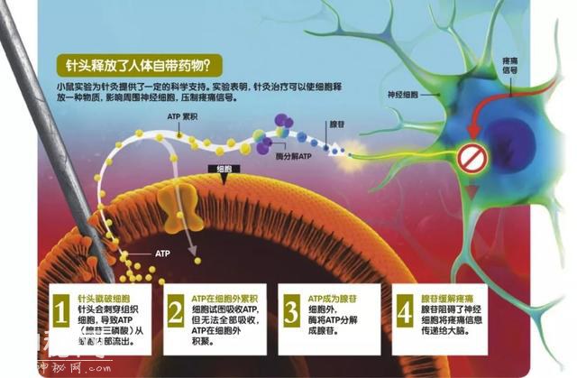 针灸：是科学还是伪科学？-3.jpg