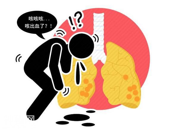 肺内有癌，如何先知？身体出现5种现象，癌症可能已到中晚期了-3.jpg