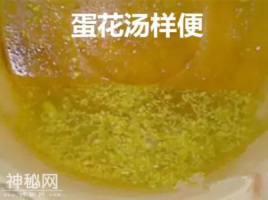 传染性超强病毒来袭，无特效药！孩子有这2种症状，别大意-6.jpg