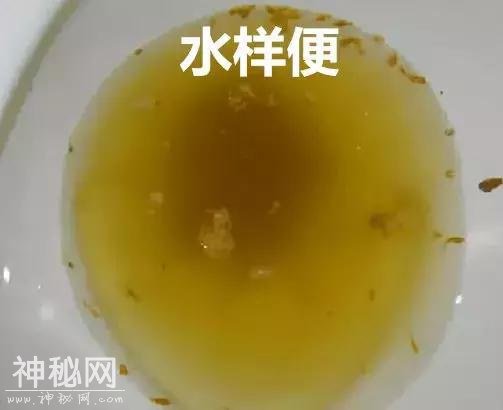 传染性超强病毒来袭，无特效药！孩子有这2种症状，别大意-5.jpg