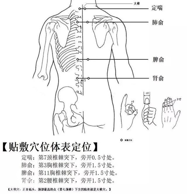 三伏贴竟有五大误区！真的不适合这些人-8.jpg