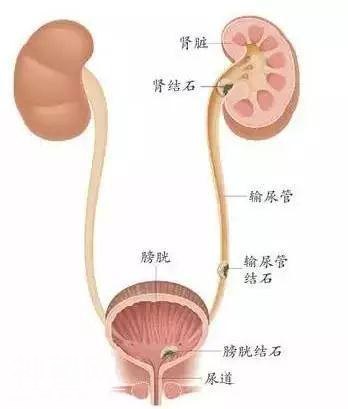 一颗埋在身体里、搅黄一顿价值3000万元午饭的小石头-5.jpg