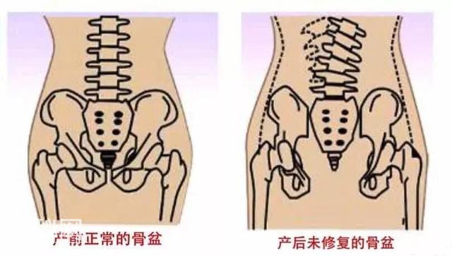 骨盆不清，小心妇科炎症找上门，是时候给自己的身体来一场大清洁-5.jpg