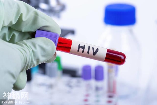 感染了HIV病毒就是得了艾滋病？别被这样的谣言吓着了-1.jpg