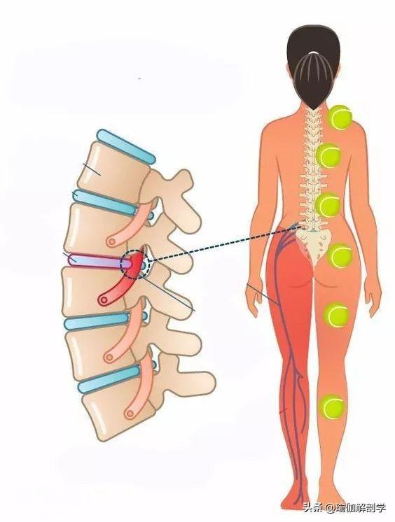 9大身体常见部位疼痛，一个网球帮你全部搞定（收藏级）-1.jpg