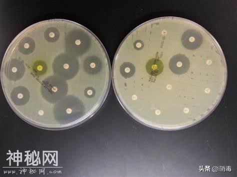 影响微生物细菌生长的因素有哪些-1.jpg