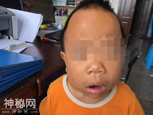 8岁男孩患怪病，深圳医疗帮扶借助基因测序找病因-1.jpg