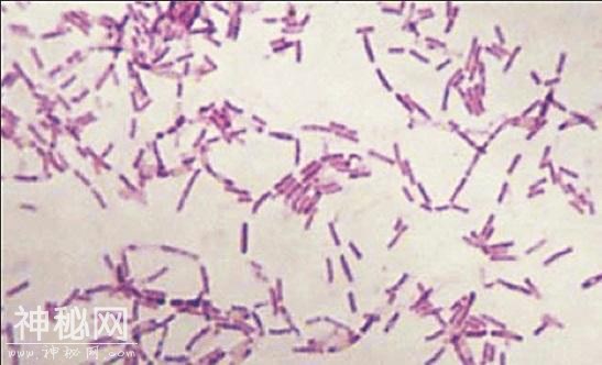 疯狂科学家为了永生，给自己注射350万年前的细菌，结果如何？-2.jpg