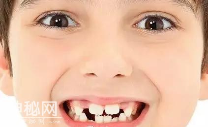 Helen齿科中心——6.1儿童节：口腔保健，儿童做起-6.jpg