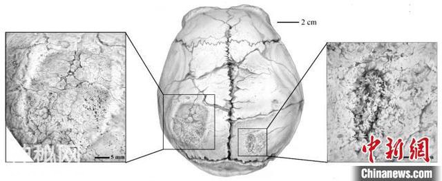 古人类学家研究揭秘：40万年前和县直立人头盖骨发现三类异常痕迹-4.jpg