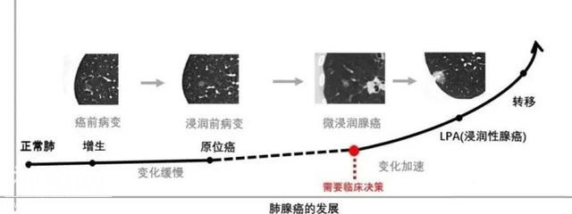 “魔术师”刘谦宣布抗癌成功，他的这个抗癌经验值得我们借鉴！-3.jpg