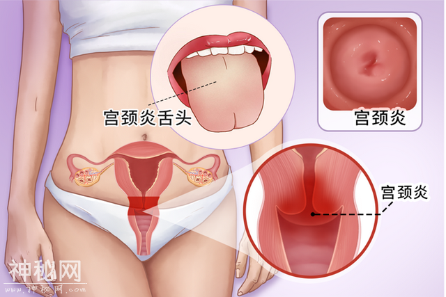 德国病理学之父：炎症是癌症的祸根，提醒：这5种炎症拖不得-4.jpg